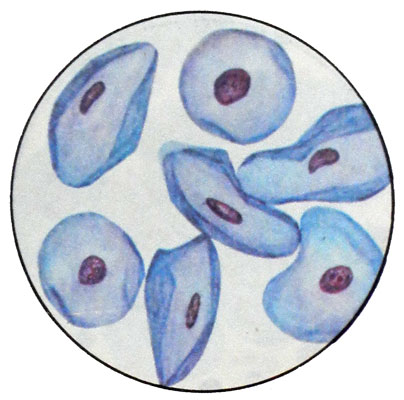 Навикулярные (ладьевидные) клетки при беременности