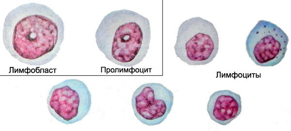 Клетки лимфоцитарного ряда - лимфобласт, промоноцит, лимфоцит