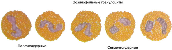 Эозинофильные гранулоциты - палочкоядерные и сегментоядерные