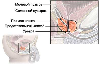 Простатэктомия - Удаление предстательной железы