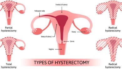 Laparoscopic hysterektomi, hysterektomi: vad är denna operation, orsaker, Kontra, hur de gör, vad efter