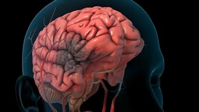 Anoksičeskoe schade aan de hersenen: wat is dit, de oorzaak van de, symptomen, diagnostiek, behandeling, het voorkomen