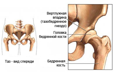 Остеотомия бедра