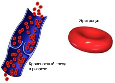 Злокачественная анемия - эритроциты