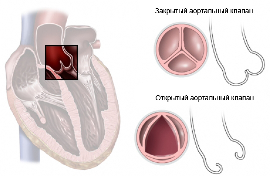 Закрытый и открытый аортальный клапан