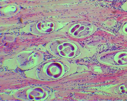 Трихинелла в мыщцах человека - Trichinella spiralis