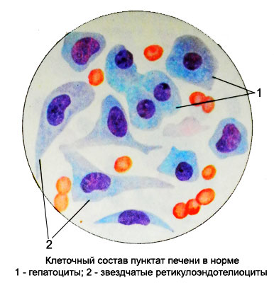 Гепатоциты и звездчатые ретикулоэндотелиоциты в нормальной печени