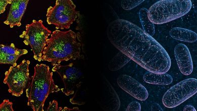 סרטן - גידול - מאפיינים מורפולוגיים של תאי גידול