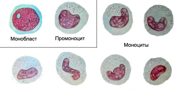Клетки моноцитарного ряда - монобласт, промоноцит, моноцит