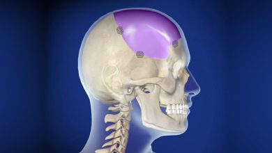 Трепанация черепа, краниотомия: что это за операция, причины, противопоказания, как делают, что после - Голова, череп, мозг