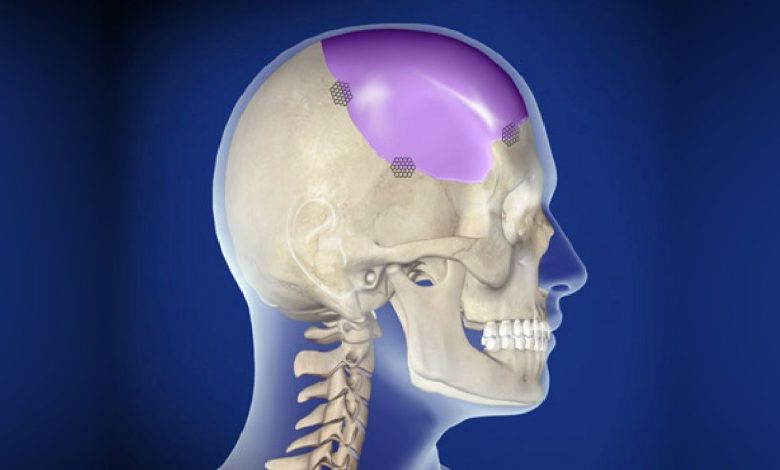 Трепанация черепа, краниотомия: что это за операция, причины, противопоказания, как делают, что после - Голова, череп, мозг