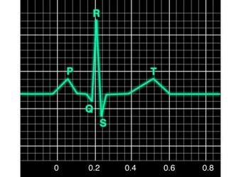 Электрокардиограмма сердца - ЭКГ