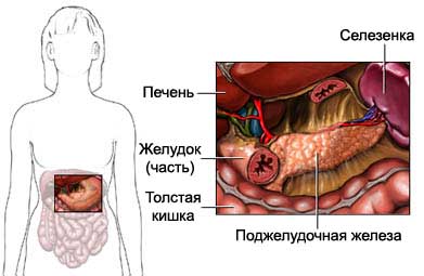 Панкреатэктомия - Резекция поджелудочной железы