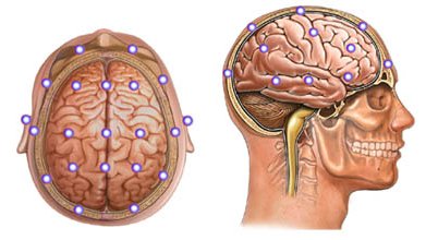 Размещение датчиков для ЭЭГ