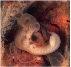 Эмбрион на 5-й неделе беременности
