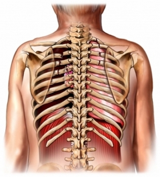 Множественные переломы ребер с повреждением легких
