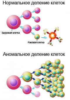 Возникновение рака