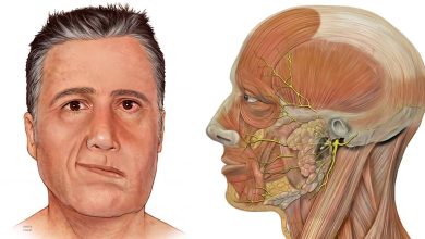 Gesichtsasymmetrie: Was ist das, Die Ursache des, Symptome, Diagnose, Behandlung, Vorbeugung