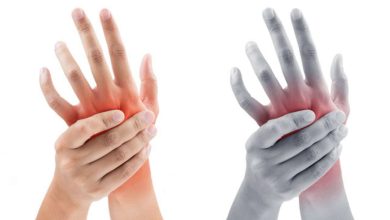 Varför gör mina händer ont? Artrit och andra orsaker till armsmärta: Vad är det, behandling, symptom, diagnostik, förebyggande