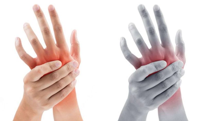 Waarom doen mijn handen pijn?? Artritis en andere oorzaken van pijn in de arm: Wat is het, behandeling, symptomen, diagnostiek, het voorkomen - Vingers, borstel, hand