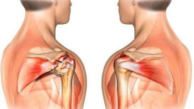 Тендинопатия плеча, повреждение сухожилия двуглавой мышцы плеча: что это такое, лечение, симптомы, диагностика, профилактика