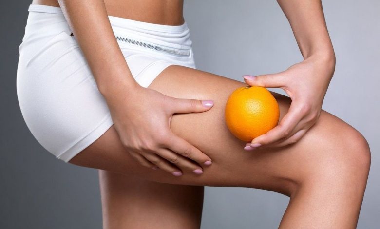 Làm thế nào để đối phó với cellulite tại nhà: thủ tục, để loại bỏ cellulite tại nhà