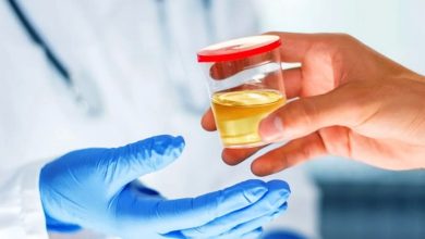 Halb uriini lõhn (haisev uriin): Mis see on, sümptomid, diagnostika, ravi, ennetamine
