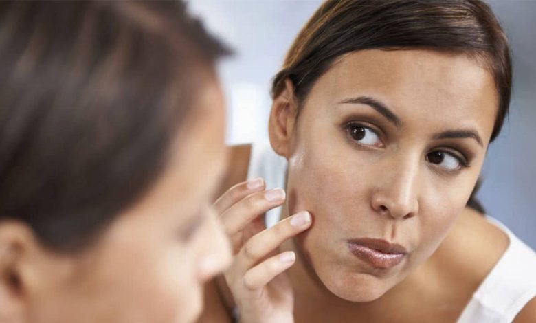 Cara menghilangkan kulit berminyak di muka - Penjagaan kulit muka - Kosmetik - Kosmetologi