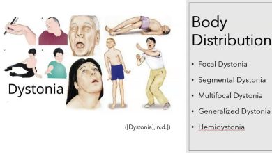 Dystonia, 근육 그룹의 통제되지 않은 수축: 이게 뭔가요, 원인, 증상, 진단, 치료, 예방