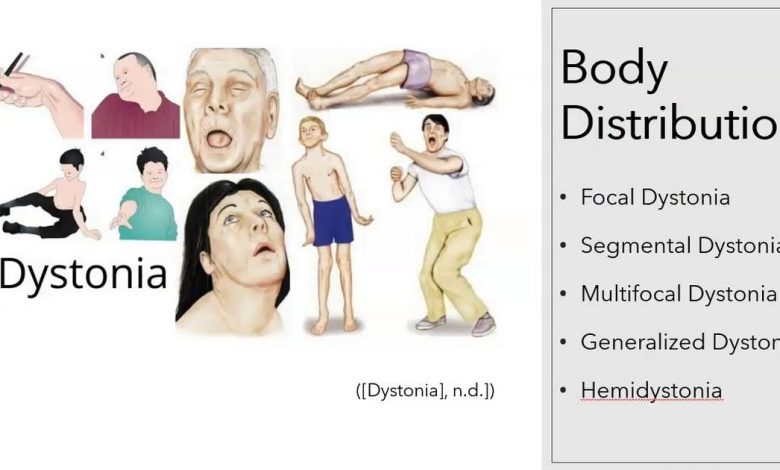 Distonia, contrações descontroladas de grupos musculares: O que é isto, causas, sintomas, diagnóstico, tratamento, prevenção