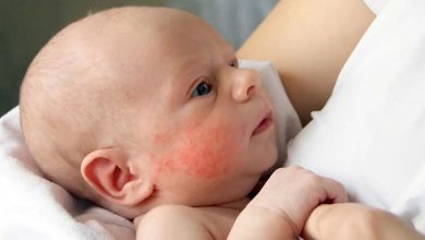 Детская сыпь у ребенка до 2 лет: что это, причины, симптомы, диагностика, лечение, профилактика