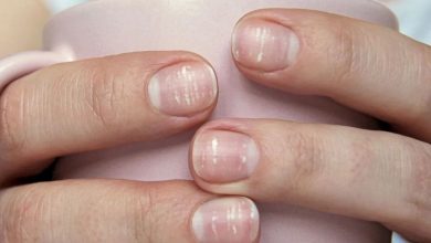 Аномалии ногтей, ломкие ногти: что это, причины, симптомы, диагностика, лечение, профилактика