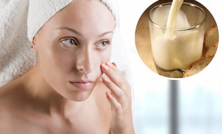 ¿Qué alimentos embellecen la piel?, que causa el acne? Qué excluir de la dieta., para deshacerse del acné?