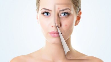 Cómo deshacerse de la piel grasa en la cara: junta, eso realmente ayuda!