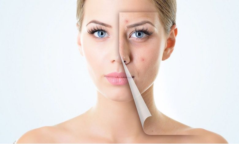 Hvordan bli kvitt fet hud i ansiktet: borde, som virkelig hjelper!