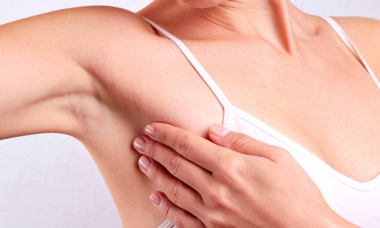 Axillary lymphadenopathy: what is this, causes, symptoms, diagnostics, treatment, prevention