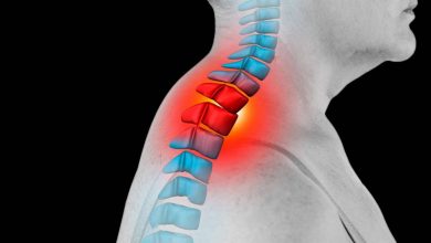 Gepa de búfal, gepa de vídua, capa de greix dorsocervical: què és això, causes, símptomes, diagnòstic, tractament, prevenció - Columna vertebral - esquena