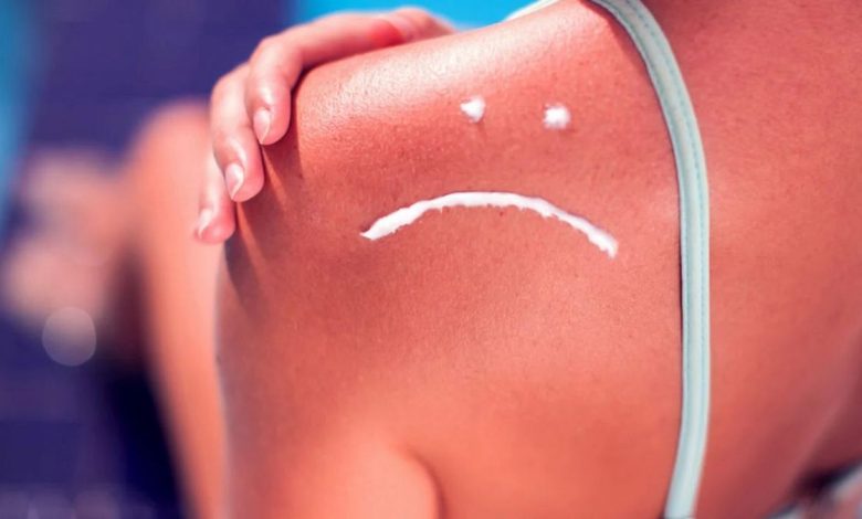 Sonnenbrand, Sonnenvergiftung: Was ist das, Ursachen, Symptome, Diagnose, Behandlung, Vorbeugung