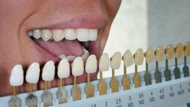 Ebanormaalne hammaste värvus (tumeneb, pleegitamine): mis see on, põhjused, sümptomid, diagnostika, ravi, ennetamine - Hambaravi