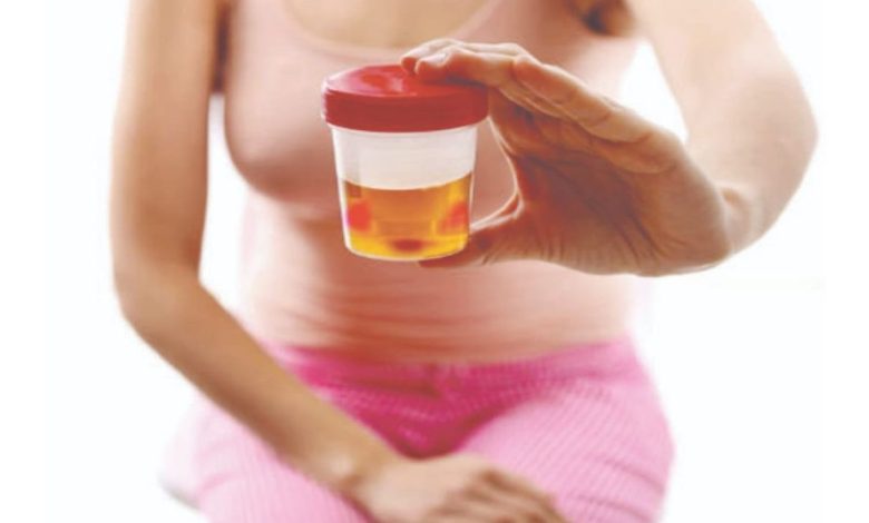 Sânge în urină, hematuria: Ce este asta, Cauze, Simptomele, diagnosticare, tratament, profilaxie