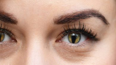 Coloboma af iris: hvad er dette, årsager, symptomer, diagnostik, behandling, forebyggelse