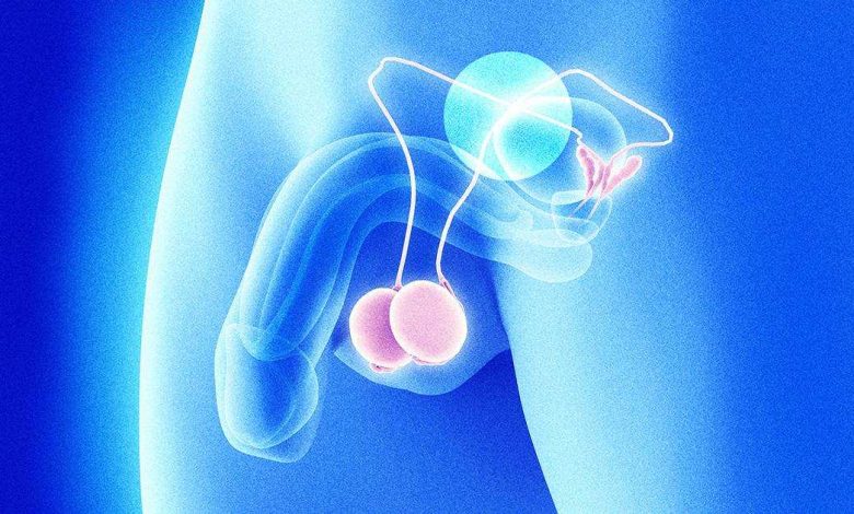 Pijn in testikels en scrotum: Wat is het, oorzaken, symptomen, diagnostiek, behandeling, het voorkomen - Penis - voortplantingssysteem