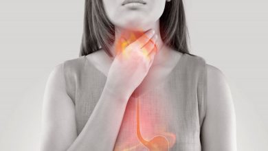 Halsbränna, GERD (gastroesofageal refluxsjukdom): Vad är det, orsaker, symptom, diagnostik, behandling, förebyggande - mag-tarmkanalen - GI