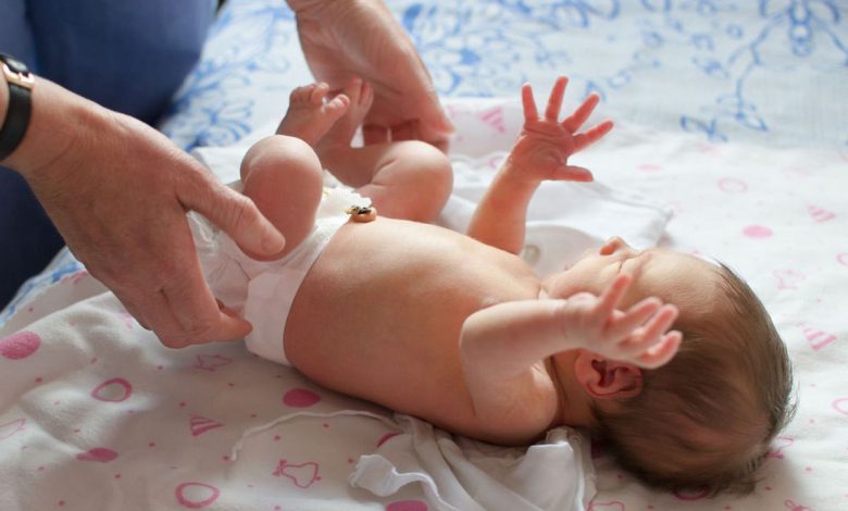 Moro-Reflex bei Babys (Schreckreflex, umarmen): Was ist es, Ursachen, Symptome, Diagnose, Behandlung, Vorbeugung - Kind - Gesundheit der Kinder, Neugeborenes