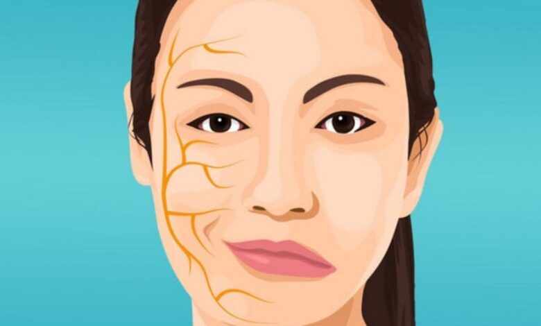 Paralisia facial (Paralisia de Bell): O que é, causas, sintomas, diagnóstico, tratamento, prevenção